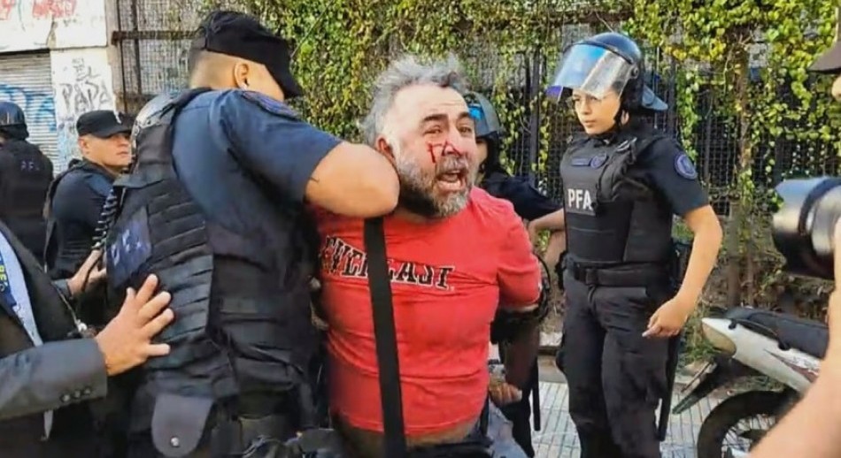 La Policía hirió y detuvo a un camarógrafo de A24 frente al Congreso